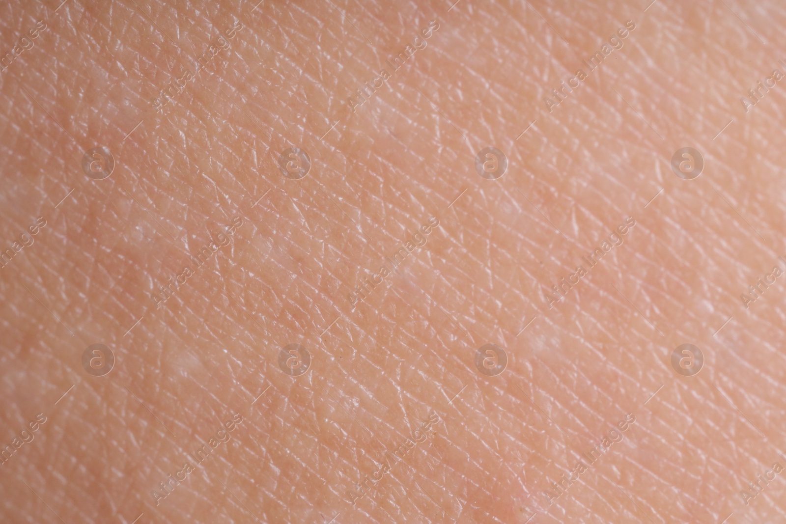 Photo of Texture of healthy skin as background, macro view