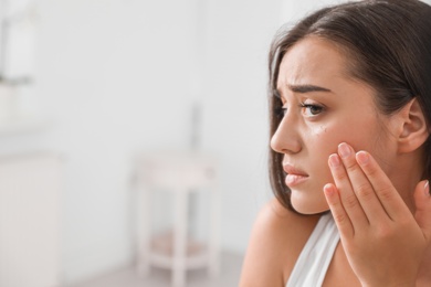 Photo of Young woman with eyelash loss problem indoors