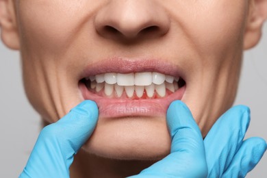 Doctor examining woman's inflamed gum on grey background, closeup