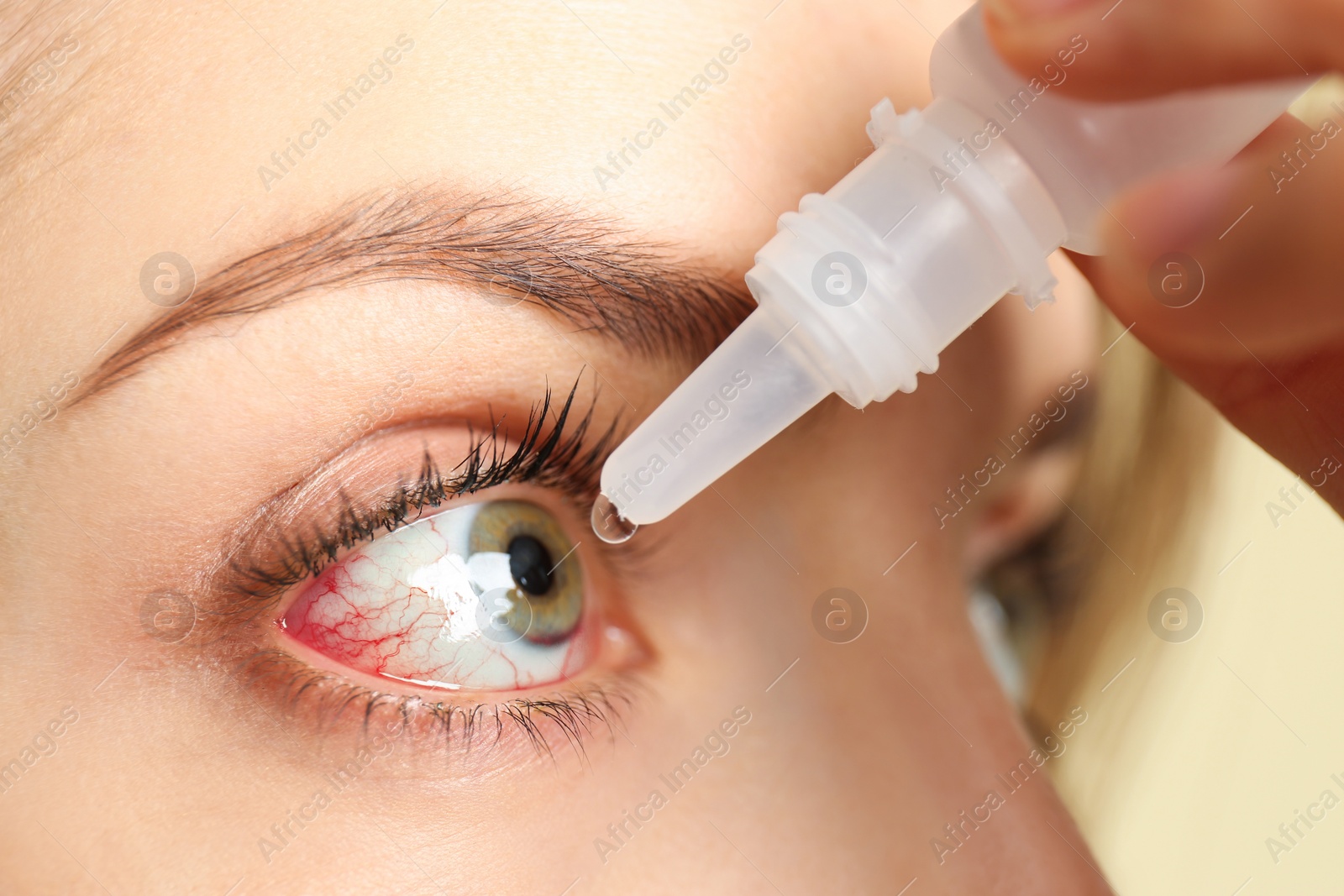 Image of Woman using eye drops on light background, closeup