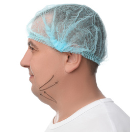 Photo of Mature man with marks on face against white background. Double chin removal