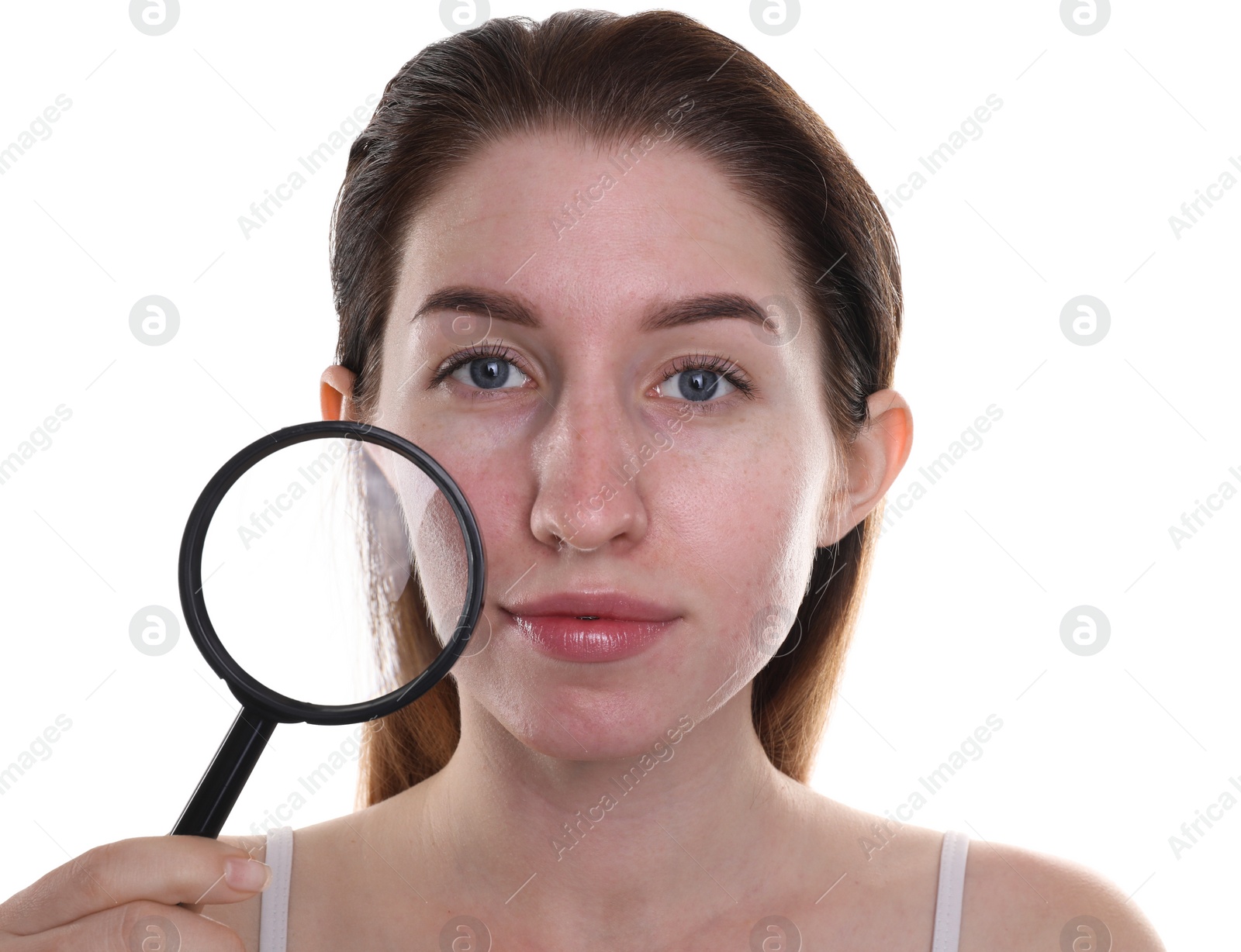 Photo of Young woman with acne problem holding magnifying glass near her skin on white background