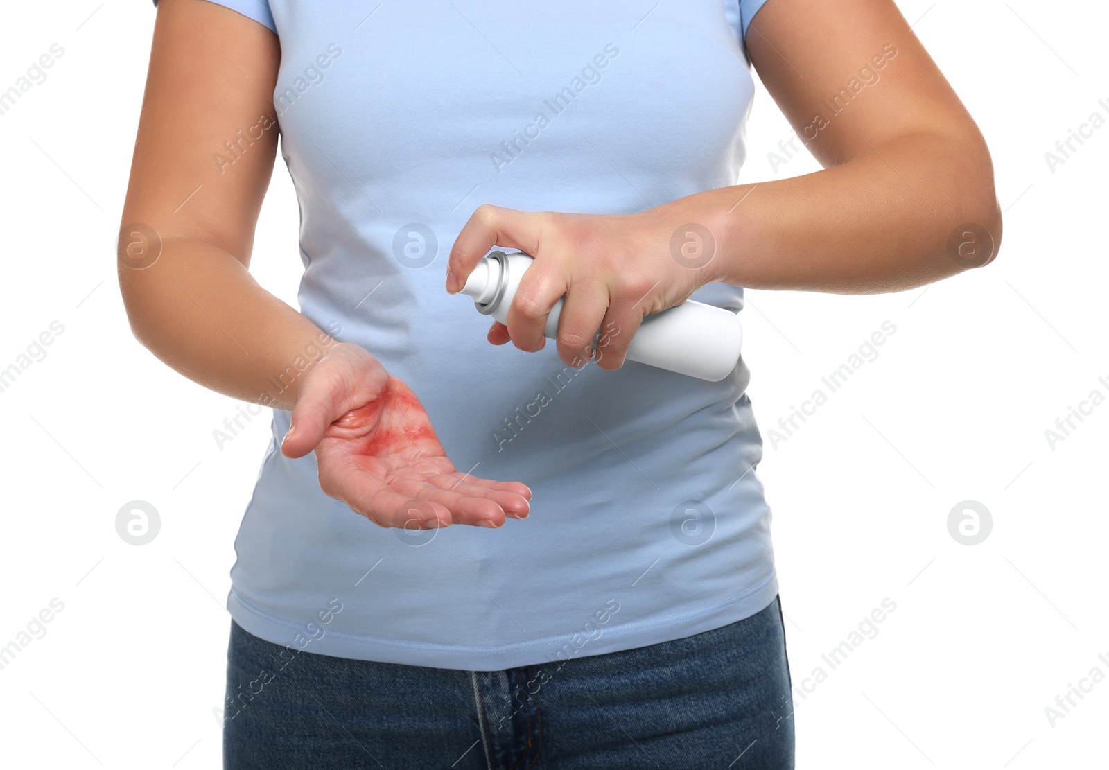 Photo of Woman applying panthenol onto burned hand on white background, closeup