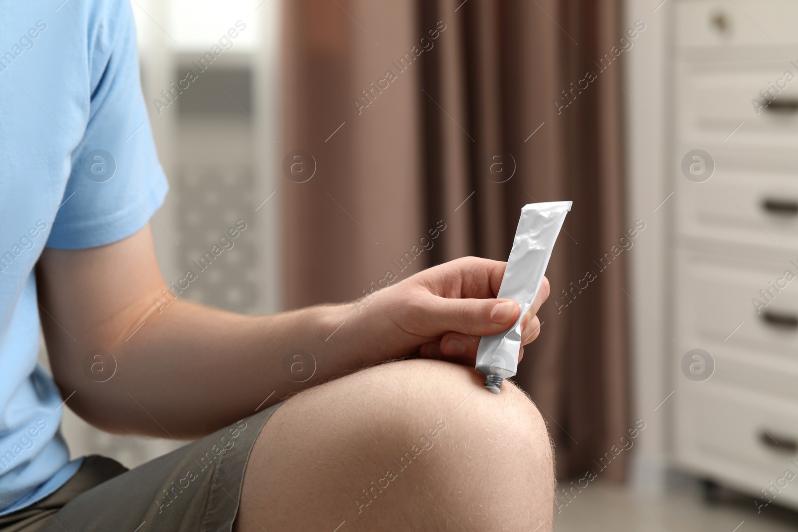 Photo of Man applying ointment from tube onto his knee indoors, closeup