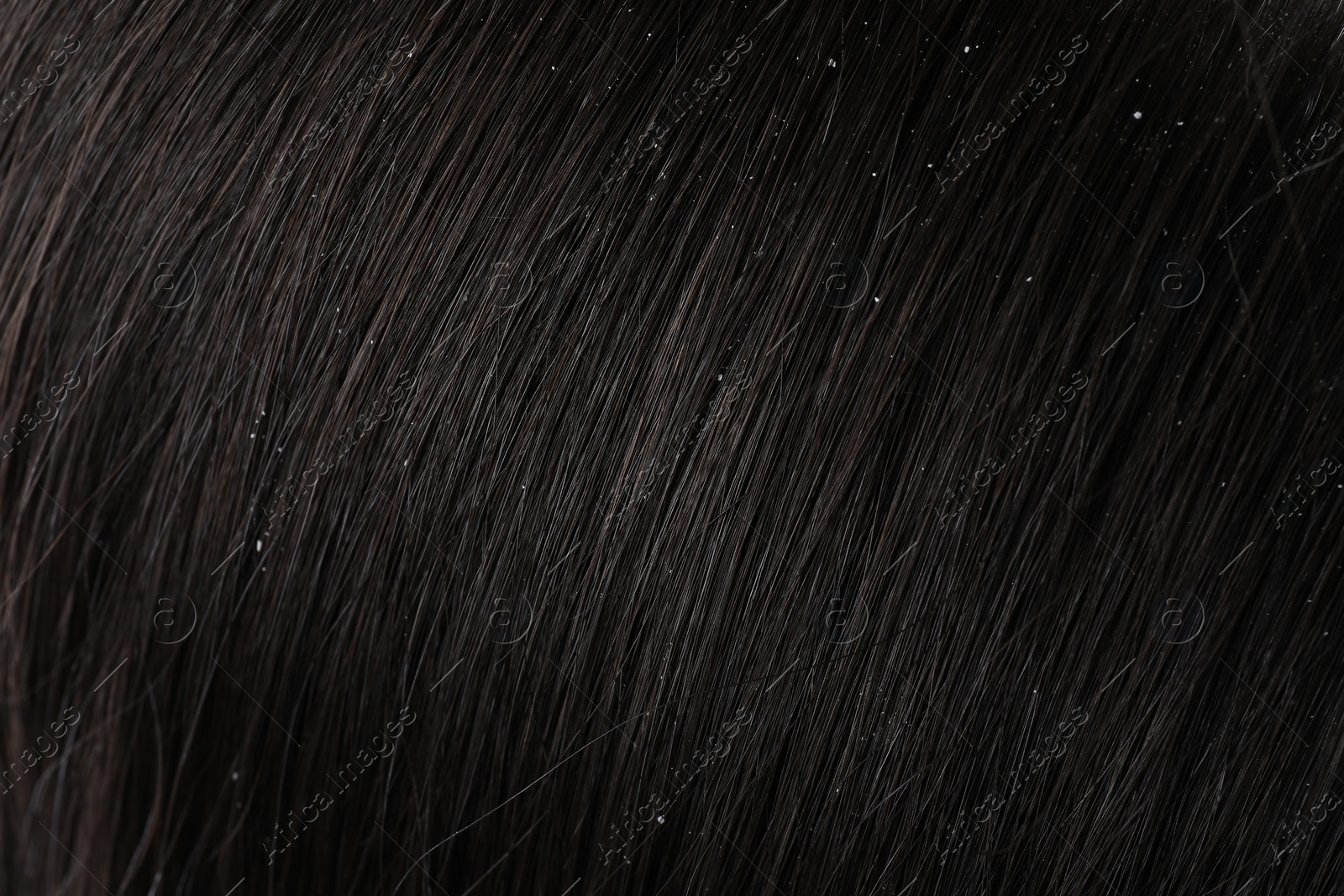 Photo of Closeup view of dark woman`s hair with dandruff