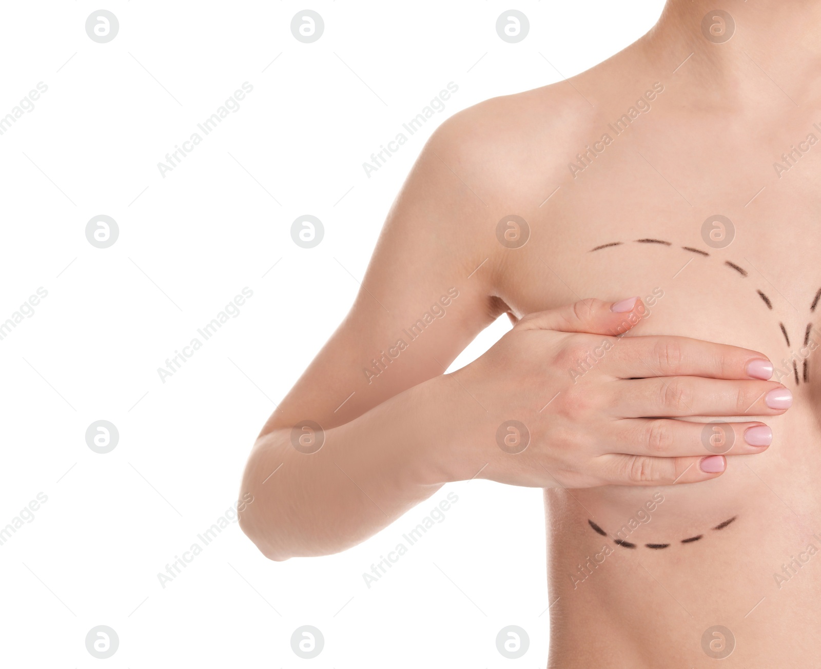 Photo of Young woman with marks on breast for cosmetic surgery operation against white background