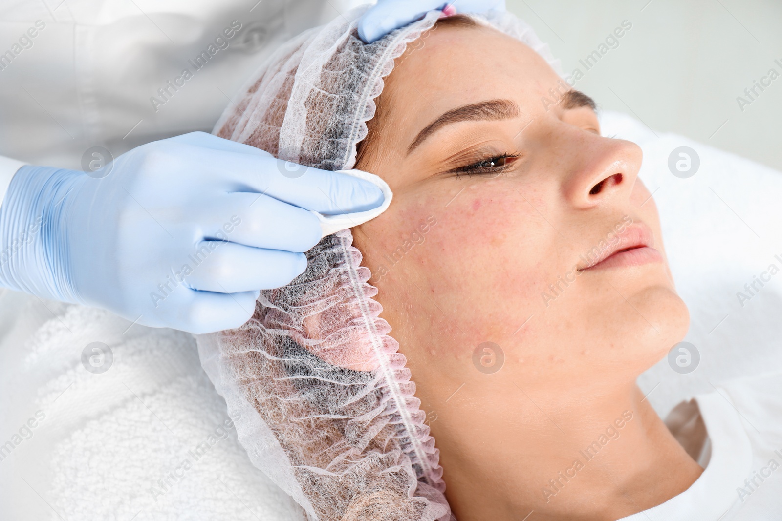 Photo of Woman undergoing face biorevitalization procedure in salon, closeup. Cosmetic treatment