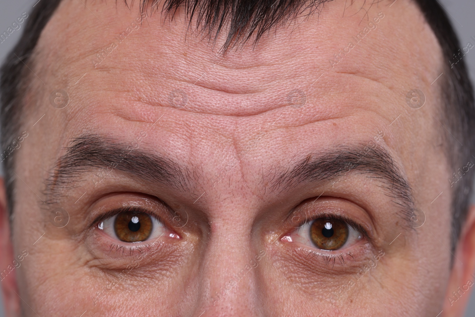 Photo of Closeup view of man with wrinkles on his forehead