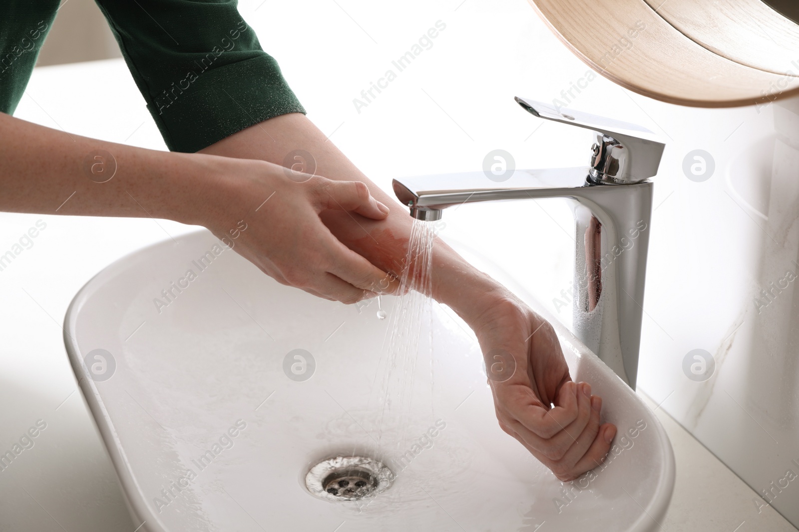 Photo of Woman putting burned hand under running cold water indoors, closeup