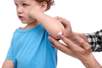 Photo of Father applying ointment onto his son`s elbow on white background, closeup
