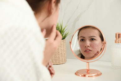 Photo of Teen girl applying acne healing patch using mirror indoors
