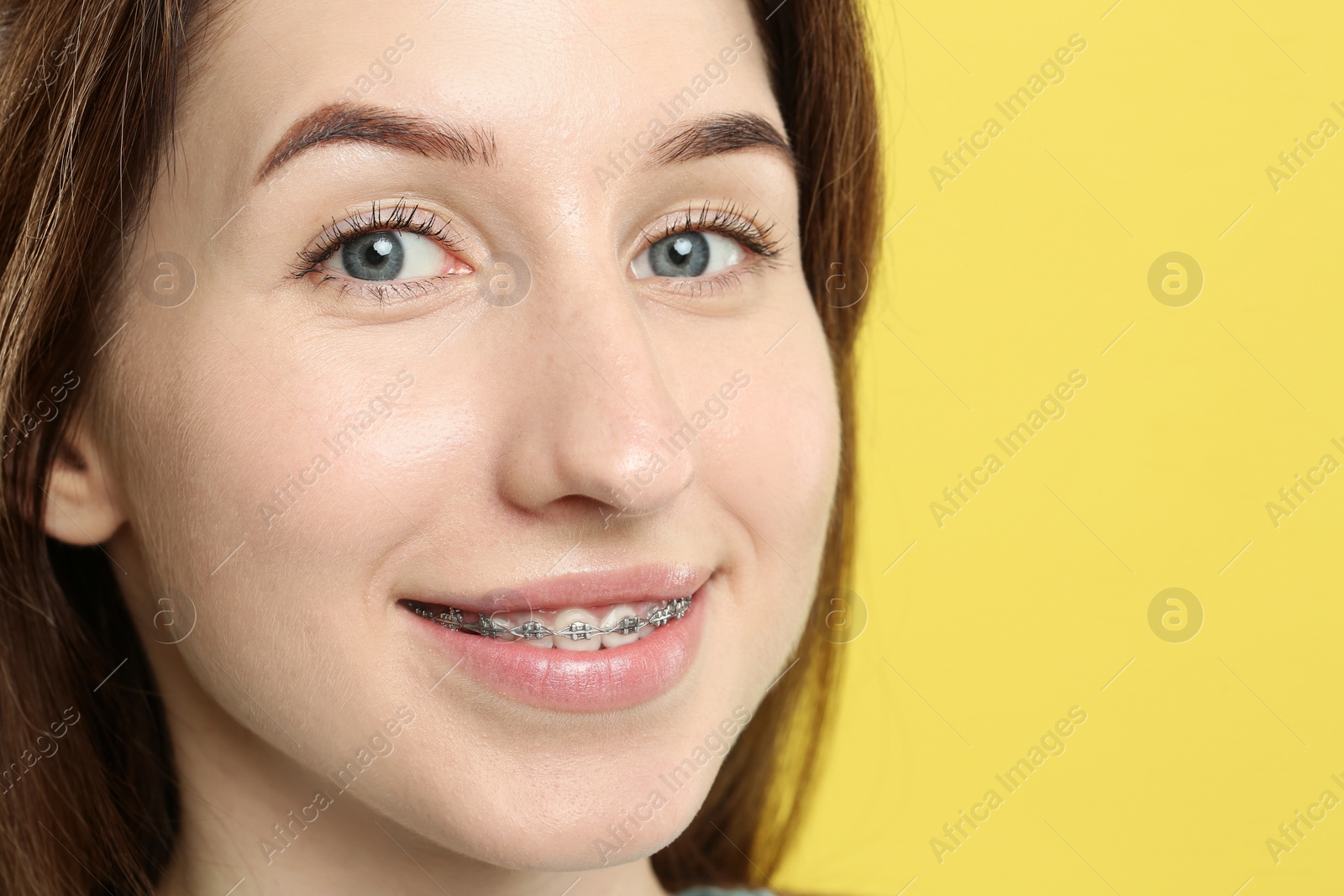 Photo of Portrait of smiling woman with dental braces on yellow background, closeup
