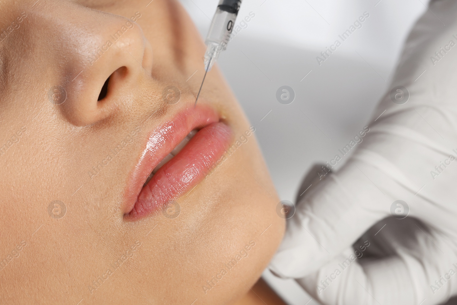 Photo of Young woman getting lips injection in clinic, closeup. Cosmetic surgery