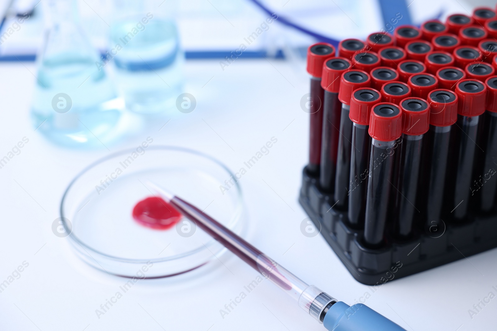 Photo of Dripping blood sample onto Petri dish on white table in laboratory, closeup