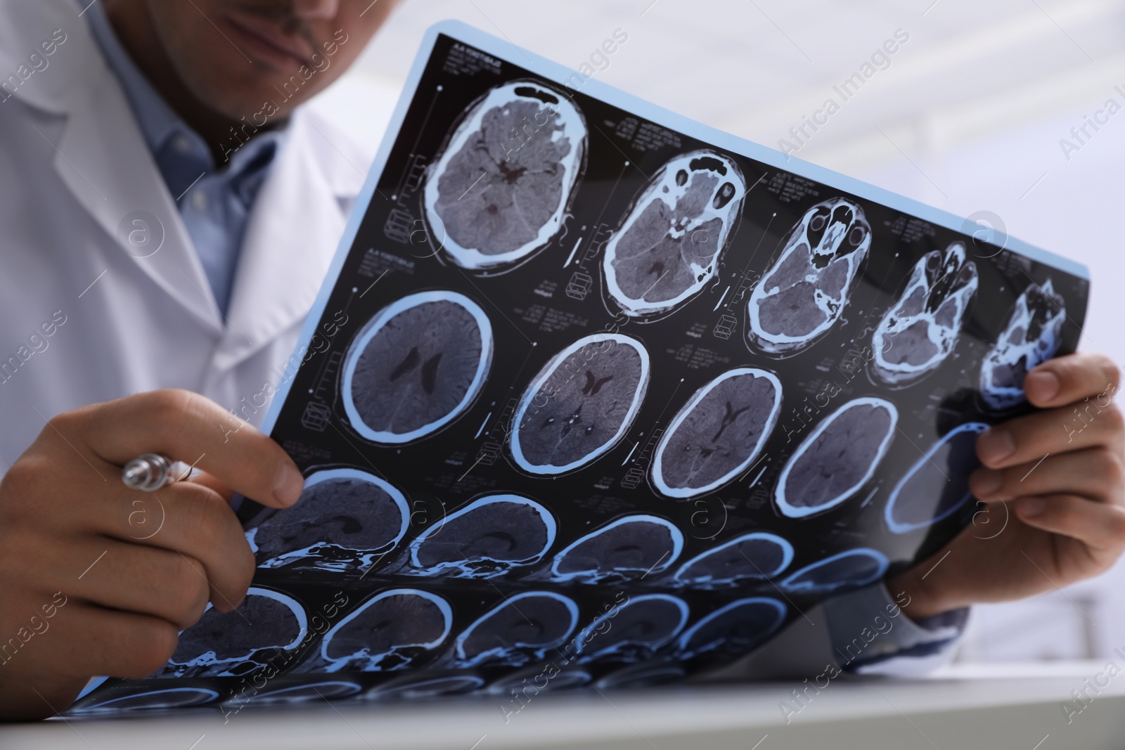 Photo of Doctor examining MRI images of patient with multiple sclerosis at table in clinic, closeup