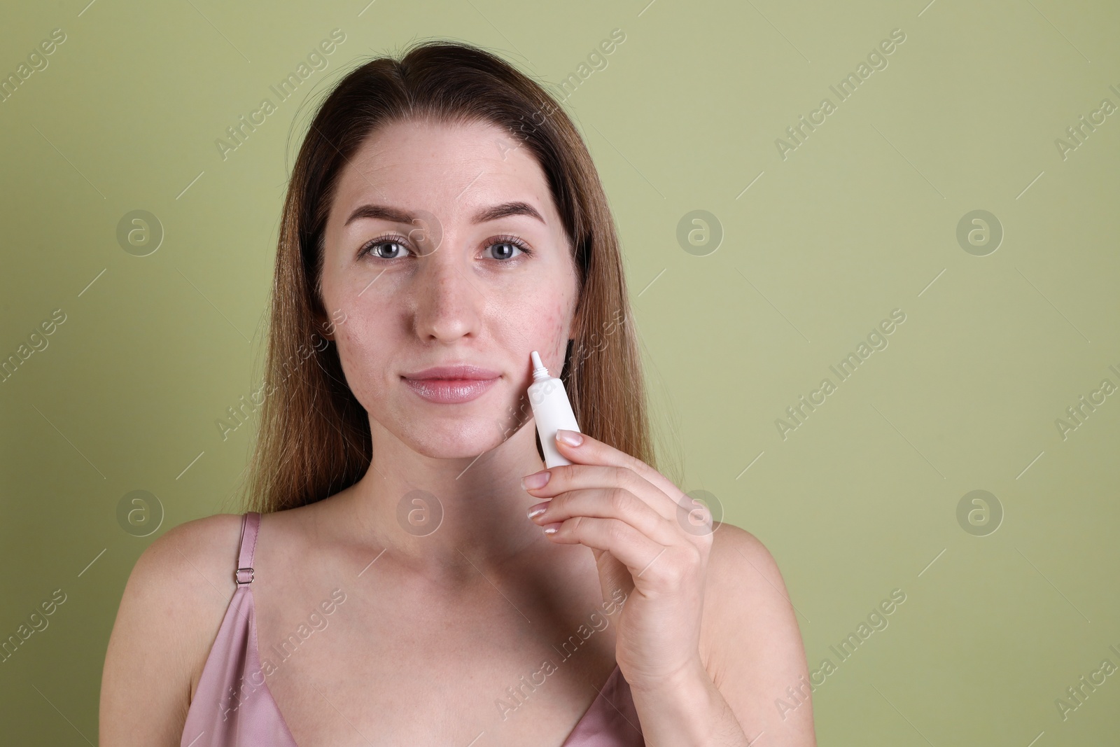 Photo of Young woman with acne problem applying cosmetic product onto her skin on olive background. Space for text