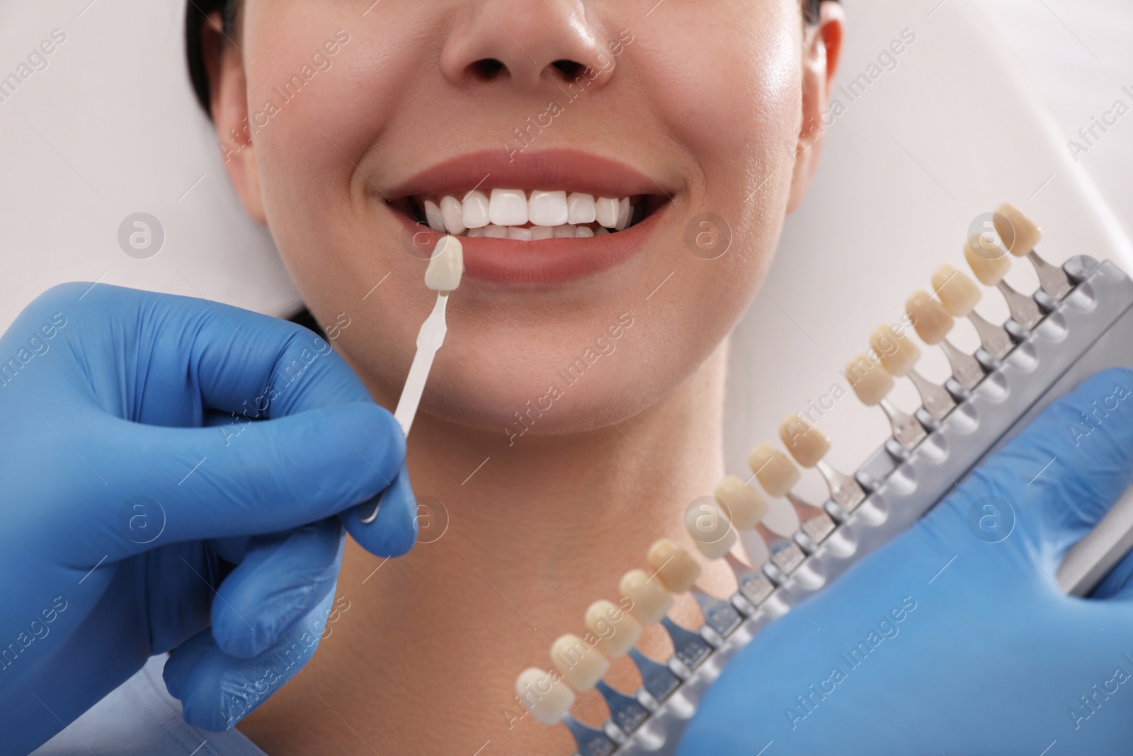 Photo of Dentist checking young woman's teeth color in clinic, closeup