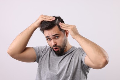 Photo of Emotional man with dandruff in his dark hair on light grey background