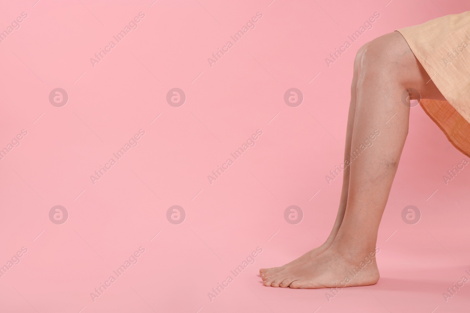 Photo of Closeup view of woman with varicose veins on pink background. Space for text