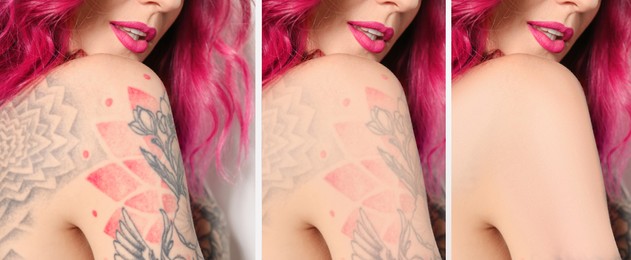 Image of Woman before and after laser tattoo removal procedures, closeup. Collage with photos, banner design