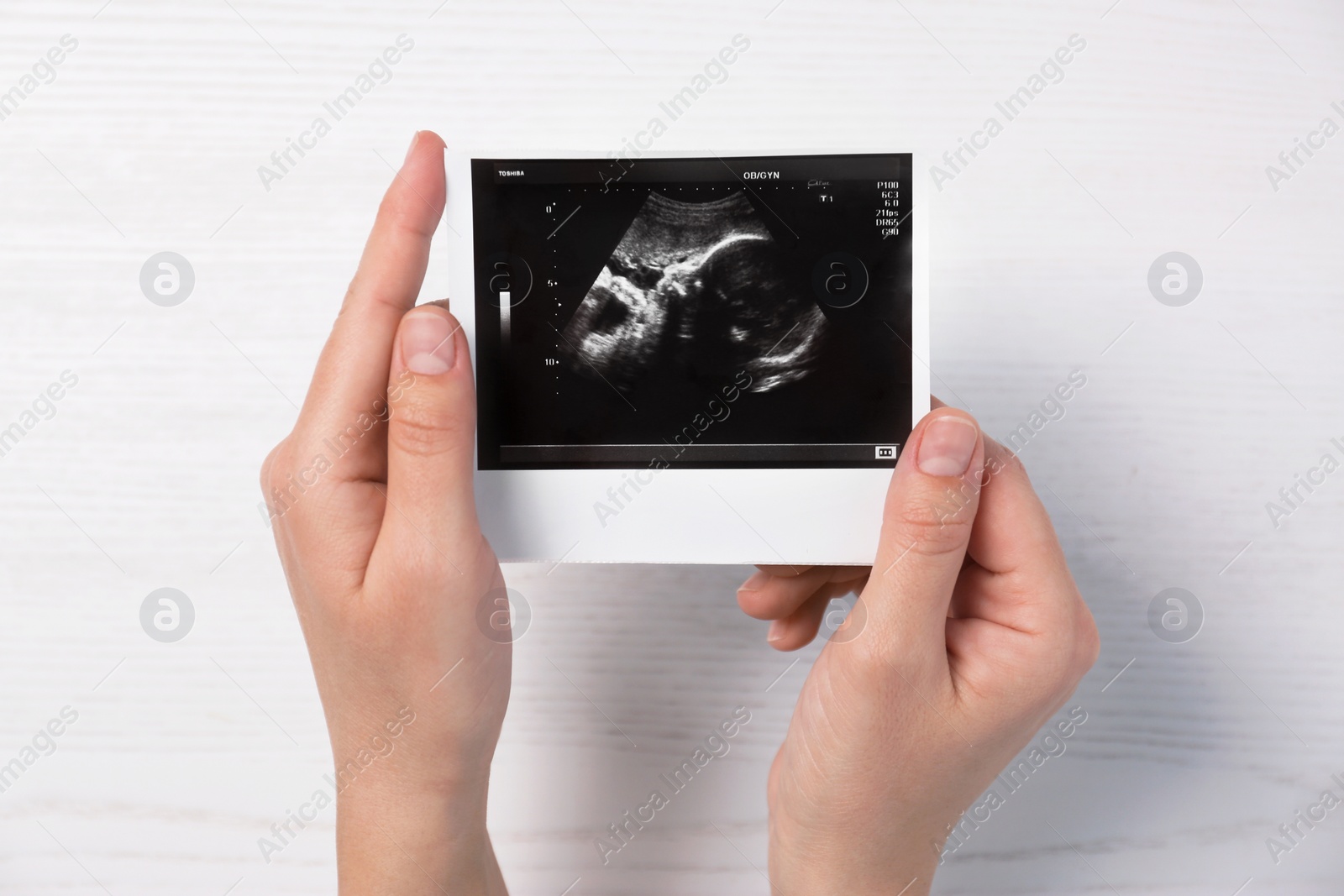 Photo of Woman holding ultrasound photo of baby over table, top view