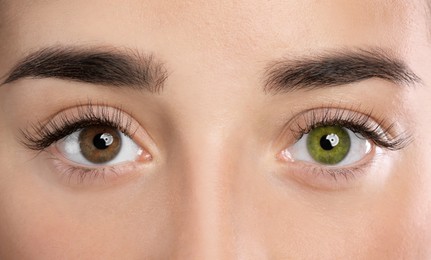 Image of Woman with different colors of eyes, closeup. Heterochromia iridis