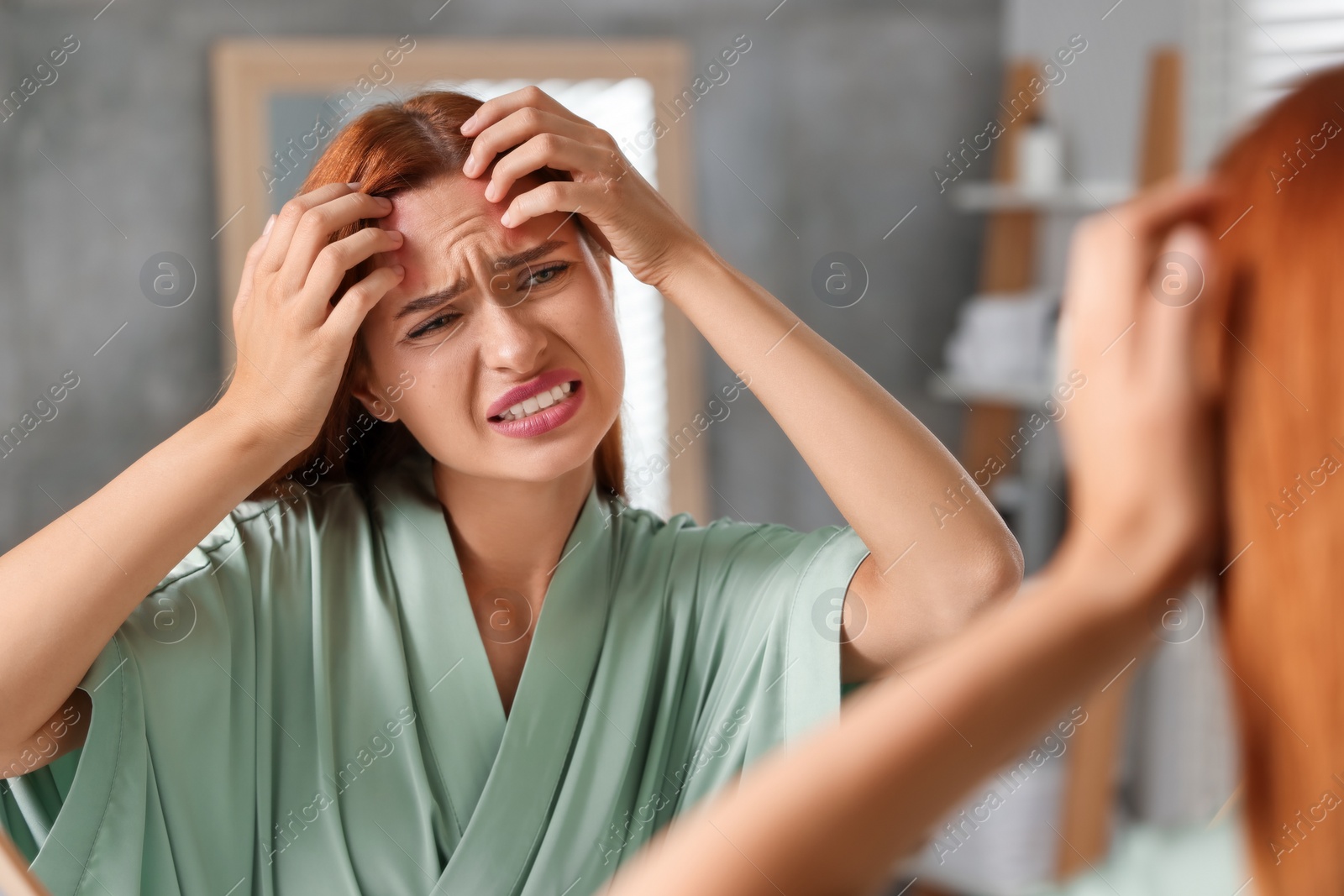 Photo of Suffering from allergy. Young woman checking her face near mirror in bathroom