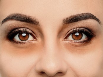 Image of Tired young woman with dark circles under eyes, closeup