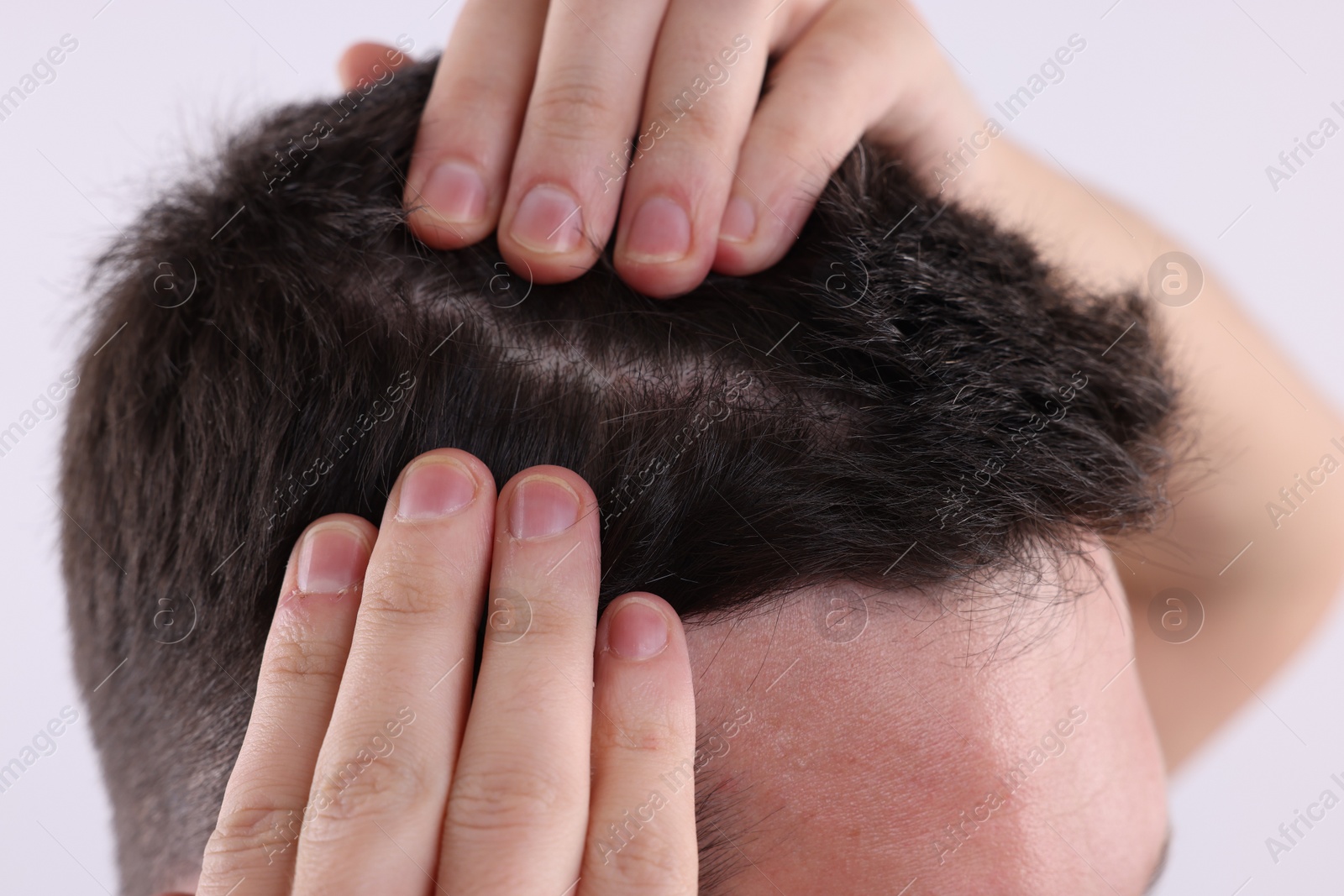 Photo of Man examining his hair and scalp on white background, closeup