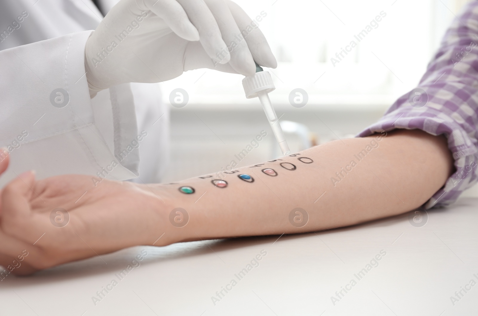 Photo of Patient undergoing skin allergy test at light table, closeup