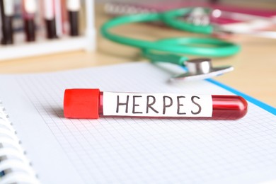 Photo of Test tube with word Herpes on notebook, closeup