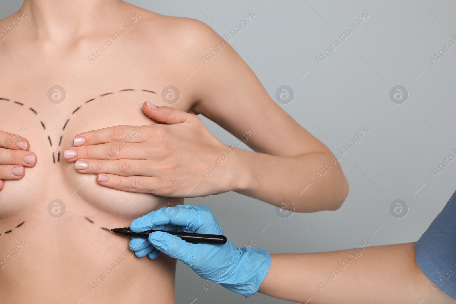 Photo of Doctor drawing marks on female breast for cosmetic surgery operation against color background