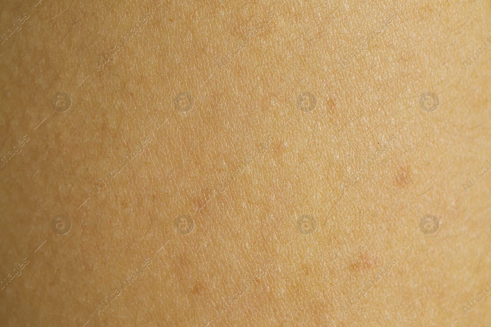 Photo of Texture of human skin as background, closeup view