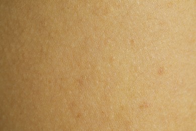 Photo of Texture of human skin as background, closeup view