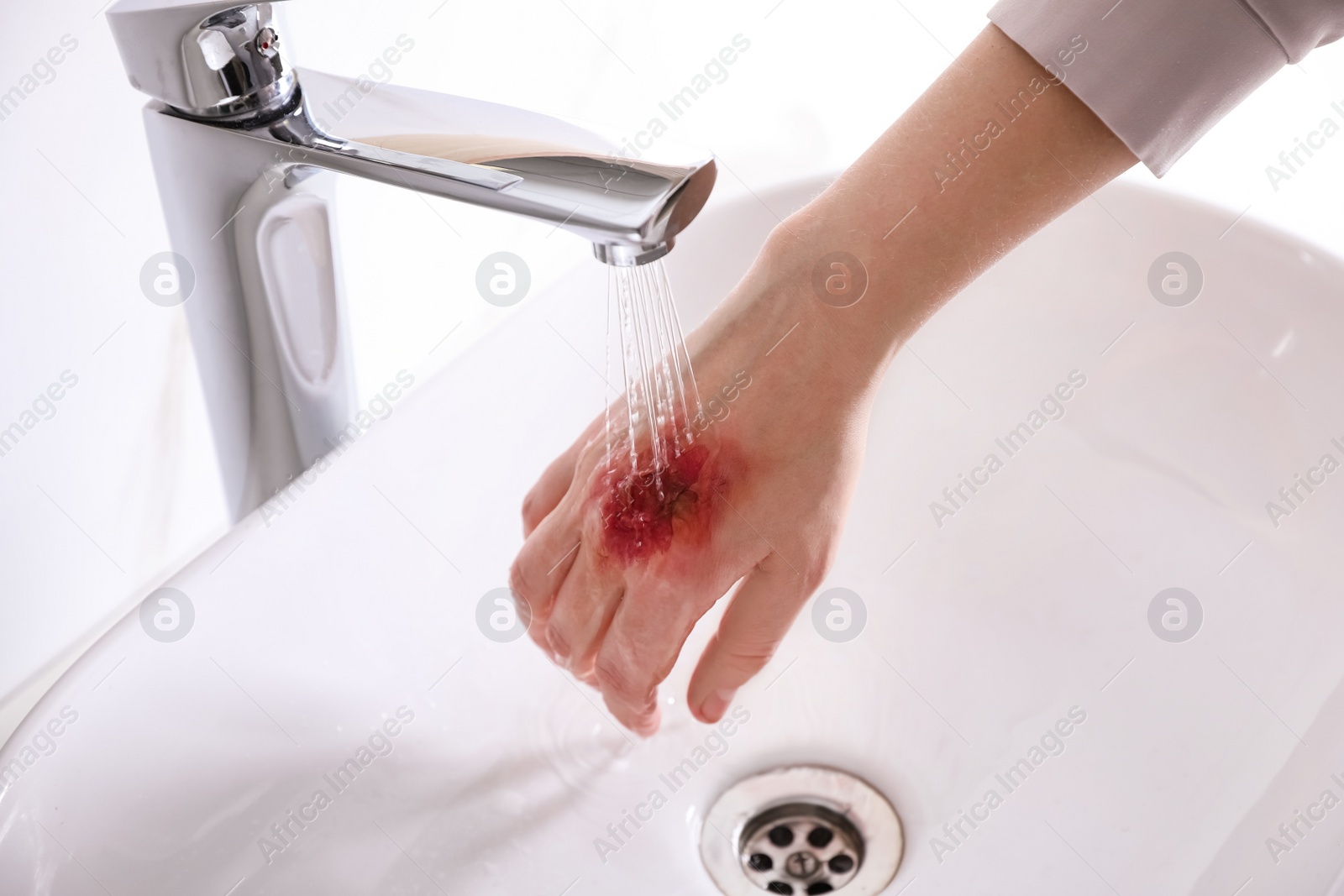 Photo of Woman putting burned hand under running cold water indoors, closeup