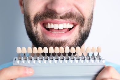 Photo of Young man with teeth color samples on light background, closeup
