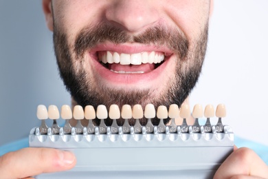 Young man with teeth color samples on light background, closeup