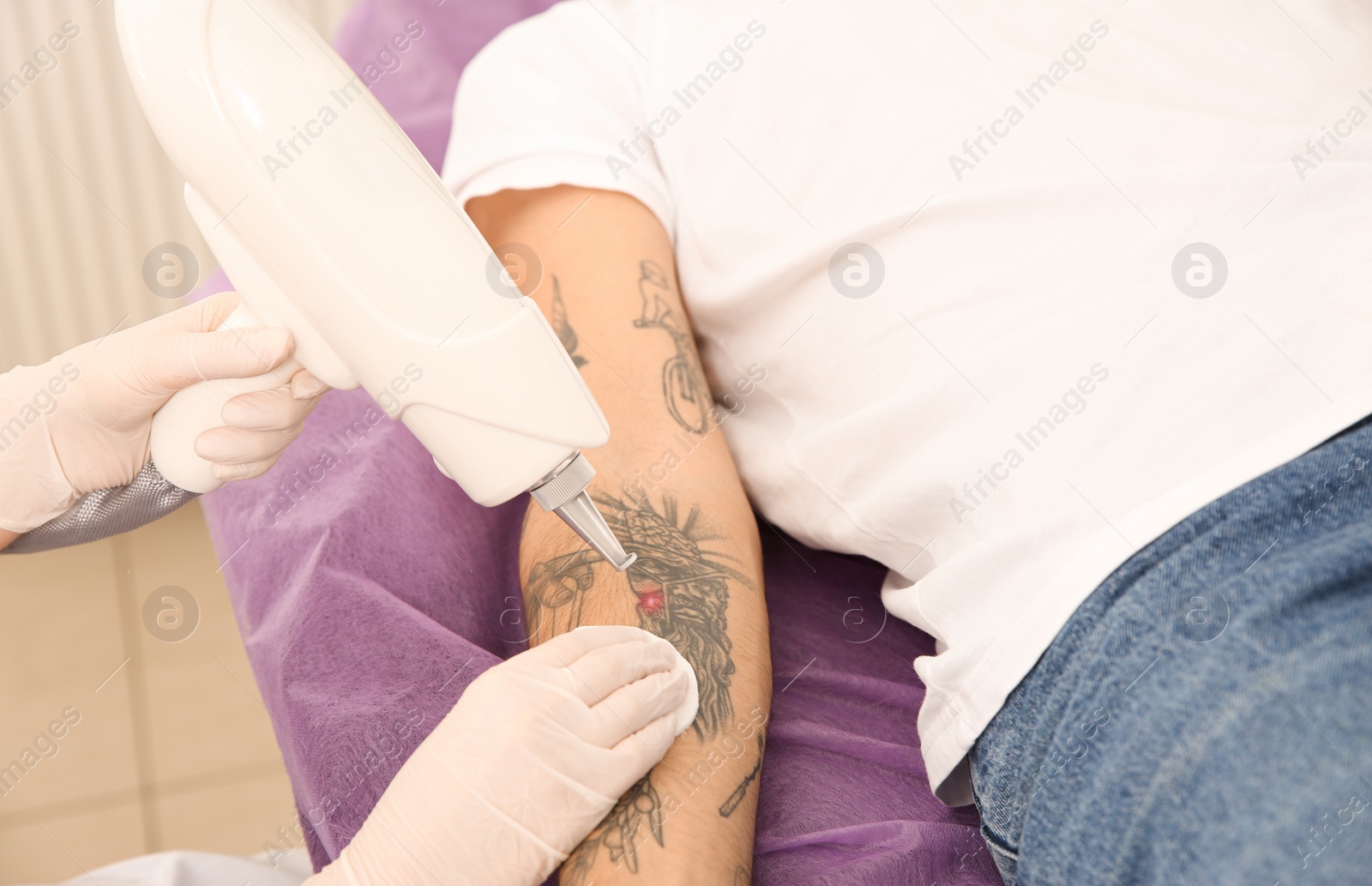 Photo of Young man undergoing laser tattoo removal procedure in salon, closeup