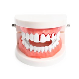 Photo of Model of jaw with blood on teeth against white background. Gum problems