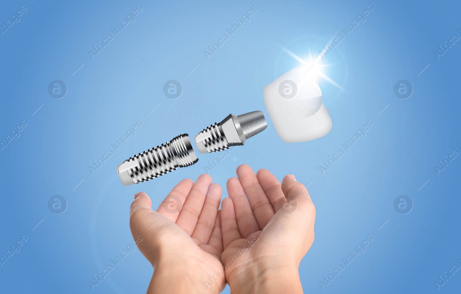 Image of Woman demonstrating dental implant on light blue background, closeup