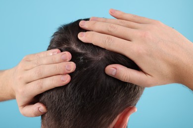 Photo of Man with dandruff in his dark hair on light blue background, back view