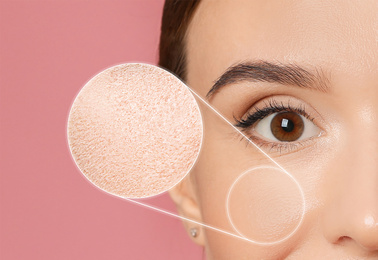 Image of Young woman with dry skin on pink background, closeup