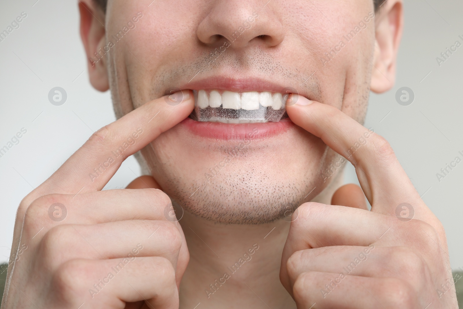 Photo of Young man applying whitening strip on his teeth against light grey background, closeup