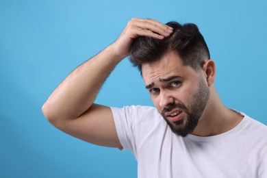 Emotional man examining his head on light blue background. Dandruff problem