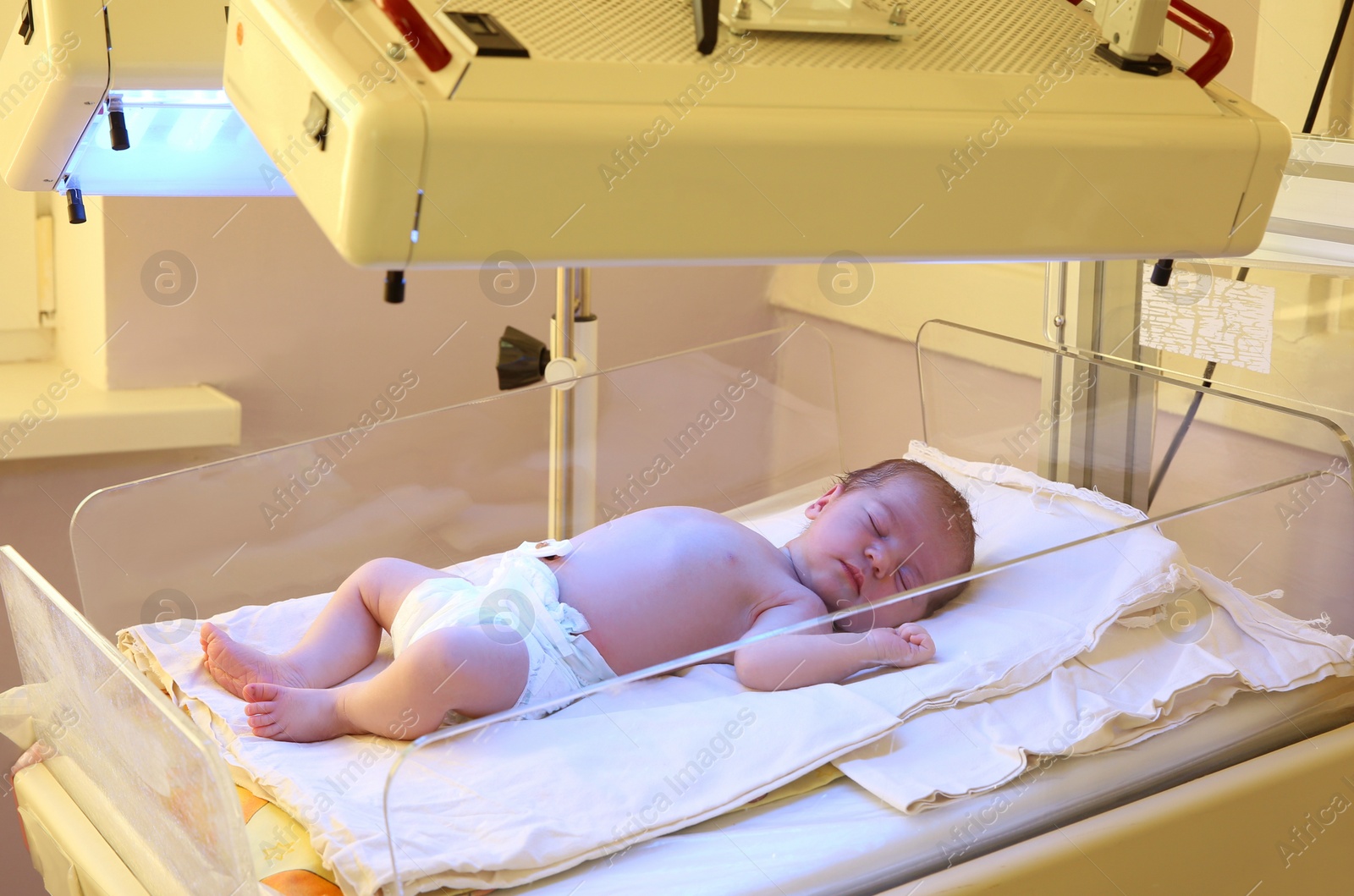 Photo of Newborn child under ultraviolet lamps in hospital