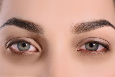 Tired young woman with dark circles under eyes, closeup