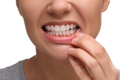 Photo of Woman showing her clean teeth on white background, closeup