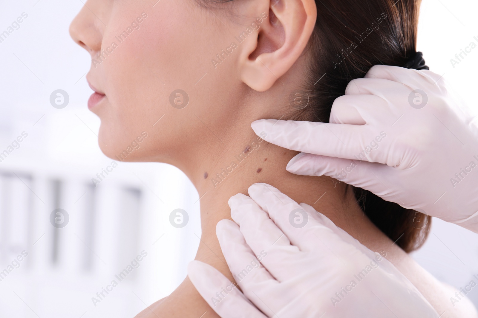 Photo of Dermatologist examining patient in clinic, closeup view
