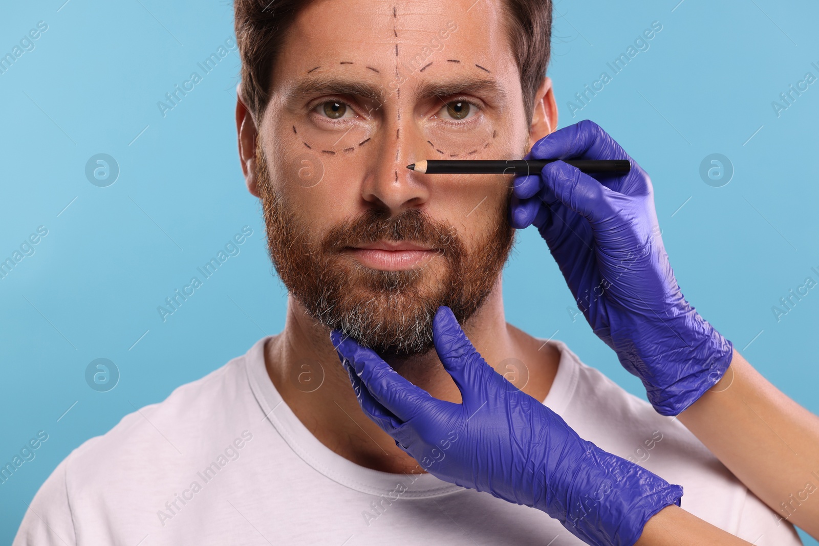 Photo of Doctor drawing marks on man's face for cosmetic surgery operation against light blue background