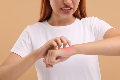 Photo of Suffering from allergy. Young woman scratching her arm on beige background, closeup